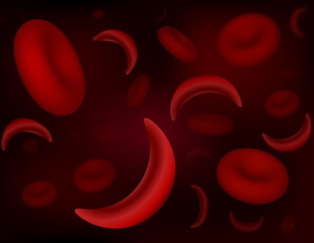 Corticosteroid exposure associated with hospitalization for severe pain event among patients with sickle cell disease
