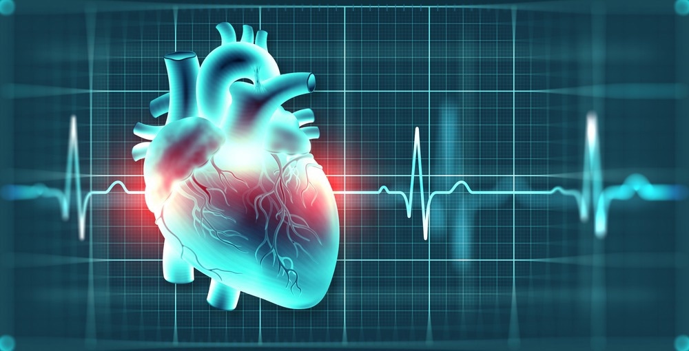 Study: COVID-19 severity and risk of subsequent cardiovascular events. Image Credit: Yurchanka Siarhei / Shutterstock.com